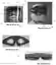 Fig. 08 - PERSONAL PROTECTIVE EQUIPMENT AND METHODS