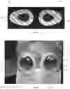 Fig. 11 - PERSONAL PROTECTIVE EQUIPMENT AND METHODS