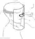 Fig. 01 - Face shield integration with eyewear
