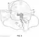 Fig. 05 - Head Covering Kit Comprising a Headscarf with a Plurality of Trimmings