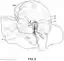 Fig. 07 - Head Covering Kit Comprising a Headscarf with a Plurality of Trimmings