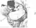 Fig. 08 - COLD WEATHER SLEEVE GARMENT