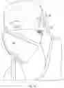 Fig. 14 - Headwear articles that are selectively convertible to a mask configuration