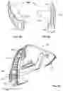 Fig. 13 - SUPPLEMENTAL IMPACT MITIGATION STRUCTURES FOR A HELMET