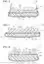 Fig. 07 - Sole structure for article of footwear