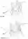 Fig. 22 - Human locomotion assisting shoe