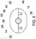 Fig. 06 - Umbrella repair assembly
