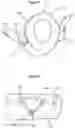 Fig. 06 - Cord support and method of making and using same