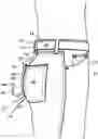 Fig. 01 - Wearable hitch