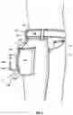 Fig. 05 - Wearable hitch