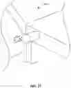 Fig. 28 - Collapsible unit for facilitating multiuse of the collapsible unit