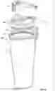 Fig. 08 - Blending system with a liner for blending container