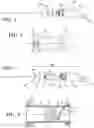 Fig. 02 - Filter assembly and filter kit for use with an endoscopic system