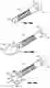 Fig. 13 - ENT INSTRUMENT WITH DEFORMABLE GUIDE HAVING TRANSLATABLE IMAGING FEATURE