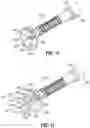 Fig. 14 - ENT INSTRUMENT WITH DEFORMABLE GUIDE HAVING TRANSLATABLE IMAGING FEATURE