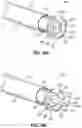 Fig. 19 - ENT INSTRUMENT WITH DEFORMABLE GUIDE HAVING TRANSLATABLE IMAGING FEATURE