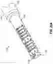 Fig. 22 - ENT INSTRUMENT WITH DEFORMABLE GUIDE HAVING TRANSLATABLE IMAGING FEATURE