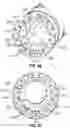 Fig. 41 - ENT INSTRUMENT WITH DEFORMABLE GUIDE HAVING TRANSLATABLE IMAGING FEATURE