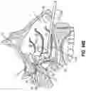 Fig. 44 - ENT INSTRUMENT WITH DEFORMABLE GUIDE HAVING TRANSLATABLE IMAGING FEATURE