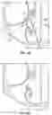 Fig. 15 - SYSTEMS, INSTRUMENTS AND METHODS FOR TREATING A SUBJECT