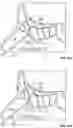 Fig. 17 - SYSTEMS, INSTRUMENTS AND METHODS FOR TREATING A SUBJECT