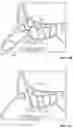 Fig. 18 - SYSTEMS, INSTRUMENTS AND METHODS FOR TREATING A SUBJECT