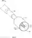 Fig. 32 - SYSTEMS, INSTRUMENTS AND METHODS FOR TREATING A SUBJECT