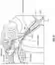 Fig. 37 - SYSTEMS, INSTRUMENTS AND METHODS FOR TREATING A SUBJECT