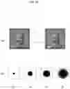 Fig. 11 - Vision correction surgery recommendation method and device