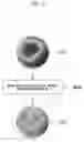 Fig. 13 - Vision correction surgery recommendation method and device