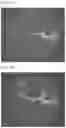 Fig. 05 - QUANTITATIVE MEASUREMENT OF THE PERIVASCULAR SPACE FOR CNS AND BRAIN DISORDERS