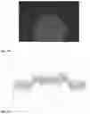 Fig. 08 - SYSTEM AND METHOD FOR FLUORESCENCE IMAGING OF BIOLOGICAL TISSUES