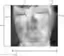 Fig. 01 - THERMAL IMAGING TEMPERATURE MEASUREMENT OF INNER CANTHUS SYSTEMS AND METHODS