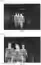 Fig. 08 - THERMAL IMAGING TEMPERATURE MEASUREMENT OF INNER CANTHUS SYSTEMS AND METHODS