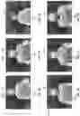 Fig. 11 - THERMAL IMAGING TEMPERATURE MEASUREMENT OF INNER CANTHUS SYSTEMS AND METHODS