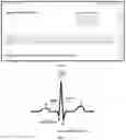 Fig. 07 - ORAL ECG DEVICE