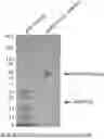 Fig. 01 - Anti-ANGPTL 3/8 complex antibodies and methods of using the same