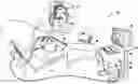 Fig. 01 - Catheter with combined position and pressure sensing structures