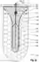 Fig. 12 - PROBE FOR IMPLANTATION INTO NERVOUS TISSUE COMPRISING A MICROELECTRODE OR A SET OF MICROELECTRODES
