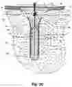 Fig. 15 - PROBE FOR IMPLANTATION INTO NERVOUS TISSUE COMPRISING A MICROELECTRODE OR A SET OF MICROELECTRODES