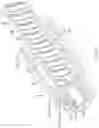 Fig. 05 - GUIDING SHEATH WITH DISTAL TIP LOCATOR