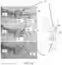 Fig. 16 - GUIDING SHEATH WITH DISTAL TIP LOCATOR