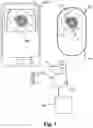 Fig. 03 - Ostomy condition classification with image data transformation, devices and related methods