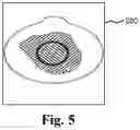 Fig. 05 - Ostomy condition classification with image data transformation, devices and related methods