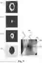 Fig. 08 - Ostomy condition classification with image data transformation, devices and related methods