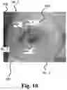 Fig. 09 - Ostomy condition classification with image data transformation, devices and related methods