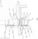 Fig. 07 - FLUOROSCOPY OPERATOR PROTECTION DEVICE
