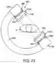 Fig. 23 - FLUOROSCOPY OPERATOR PROTECTION DEVICE