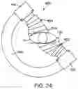 Fig. 24 - FLUOROSCOPY OPERATOR PROTECTION DEVICE