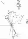 Fig. 02 - Metal artifacts reduction in cone beam reconstruction